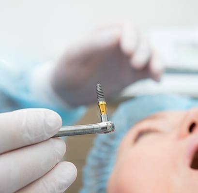 Dentist about to place titanium rod in patient’s jaw