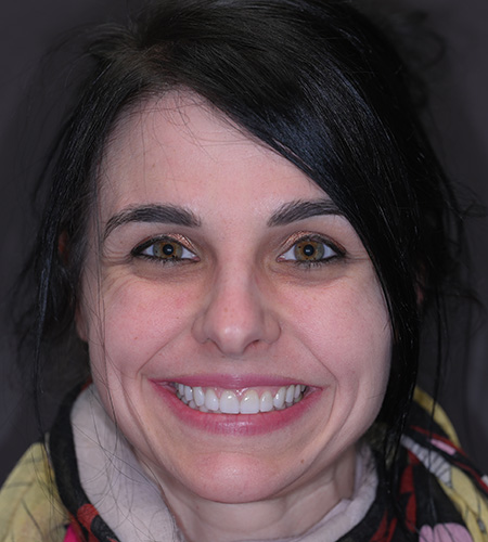 Man smiling after dental treatment