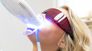 Woman receiving a teeth whitening treatment